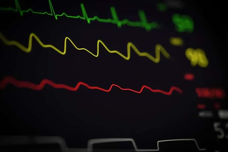 #4 - Implanted Medical Devices That Trigger Metal Detectors (Image Credits: Unsplash)
