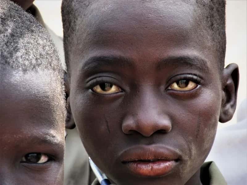 7. Burkina Faso (Image Credits: Pexels)