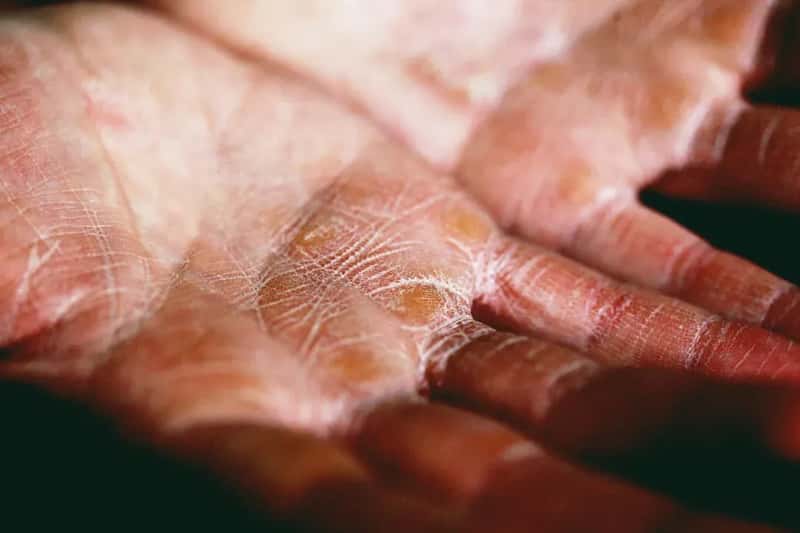 What Dehydration Does to Your Skin, Eyes, and Taste Buds (Image Credits: Unsplash)