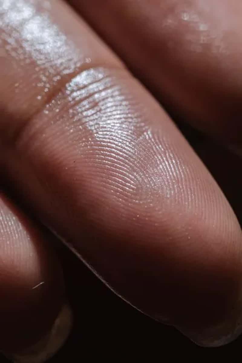 2. Sweaty palms show up out of nowhere (Image Credits: Pexels)