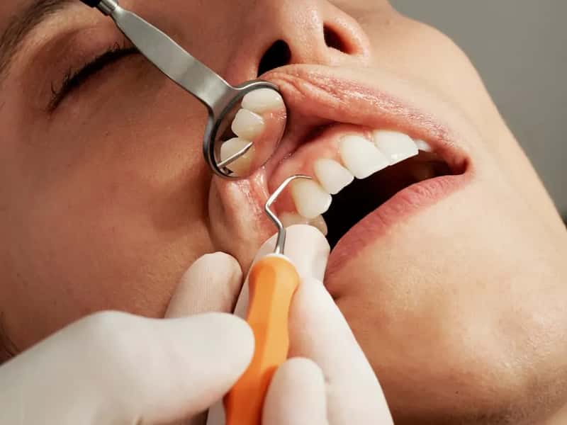 Dental Work That Doesn't Break the Bank (Image Credits: Unsplash)