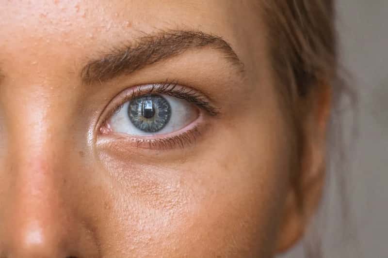 3. Skin, eyes, and throat that feel unusually dry (Image Credits: Unsplash)