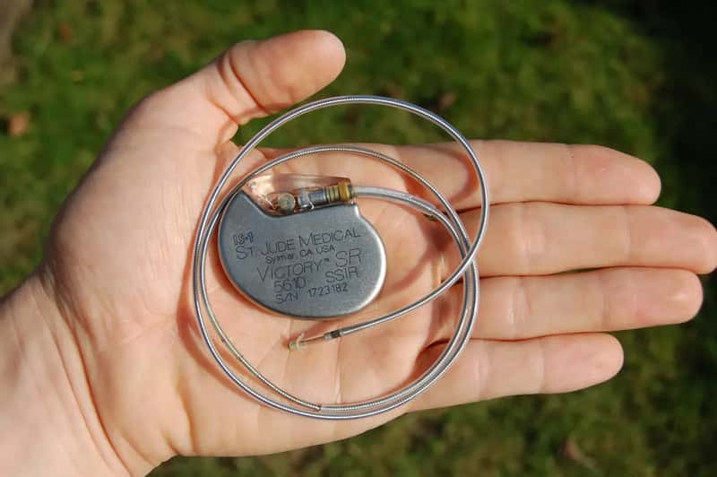 #14 - Your Pacemaker Means You Should Never Go Through the Metal Detector (Own work, removed from a deceased patient before cremation. Holding it in my hand., CC BY 3.0)